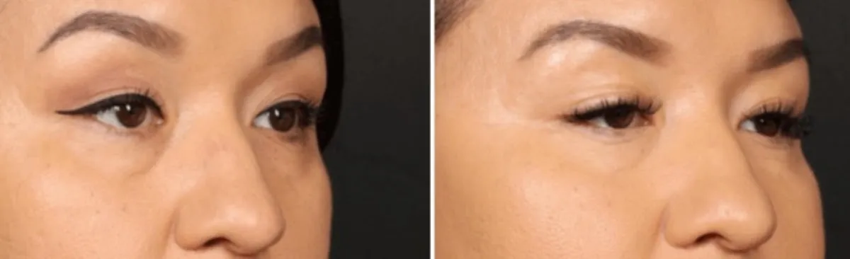 Maloney Plastic Surgery in Tucson