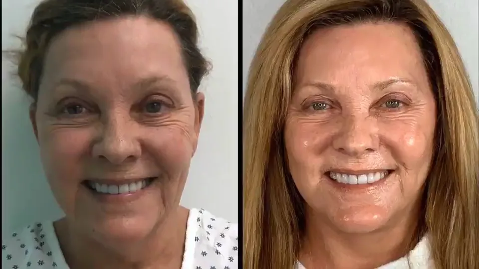 Petro Facial Plastic Surgery in Birmingham